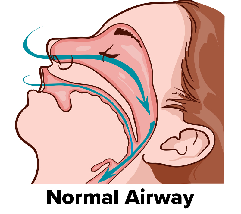 sleep apnoea clinic near me